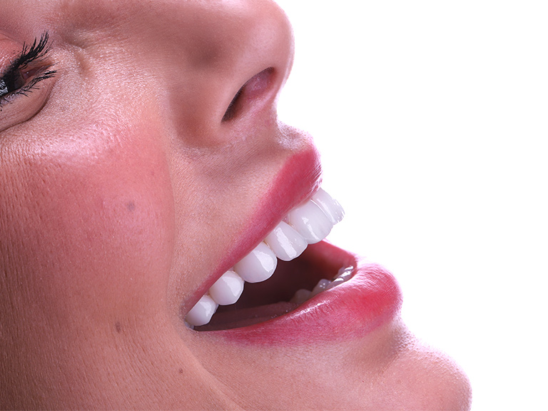 Lentes de contato dental com dentista em Canoas, RS